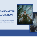 Drug Addiction Before and After