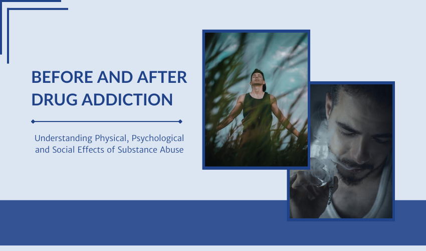 Drug Addiction Before and After